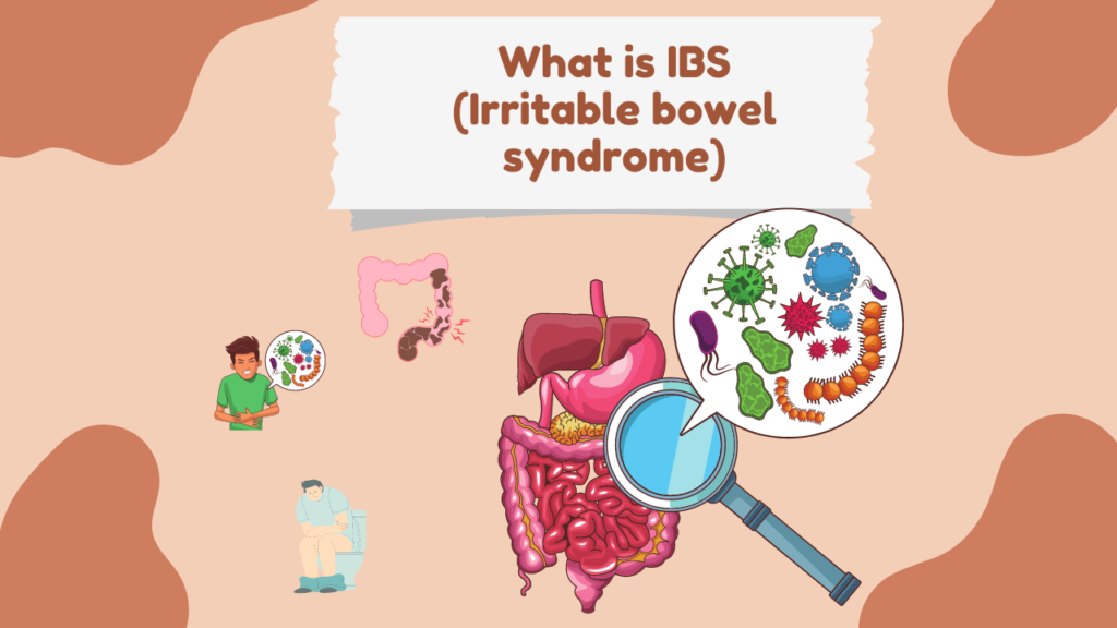 what is ibs
