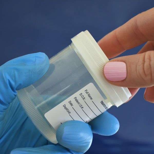 Medical personnel doctor nurse handing patient urine specimen cup for sample to be tested.